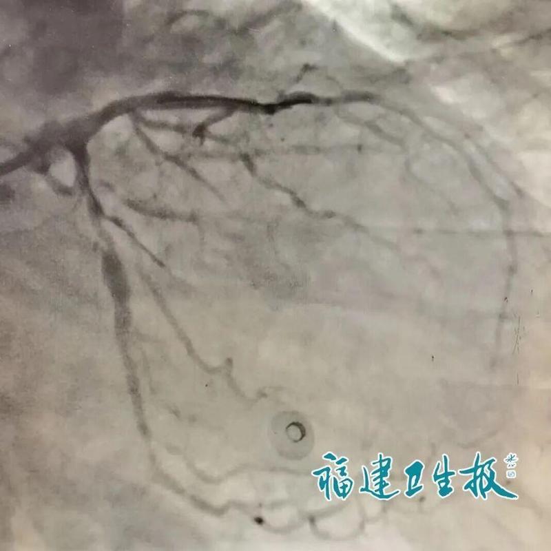  盲目坚持返乡治疗：一场以生命为赌注的“任性”博弈 健康养生