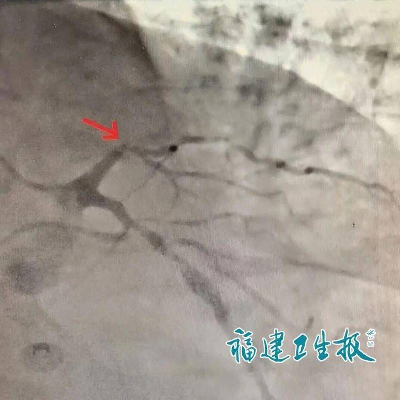  盲目坚持返乡治疗：一场以生命为赌注的“任性”博弈 健康养生